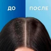 Шампунь против перхоти "Head & Shoulders" Цитрусовая свежесть 400 мл